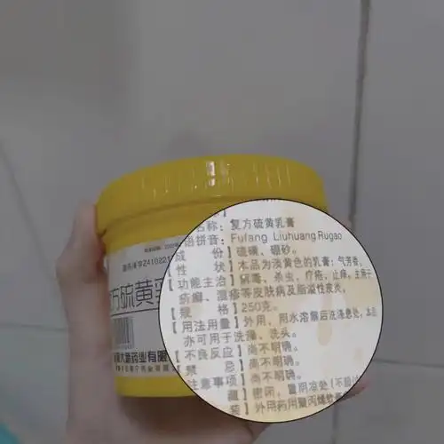 头痒和头屑02退60硫磺乳膏78