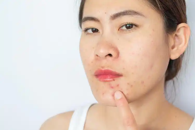 不同原因造成的皮肤敏感该如何处理