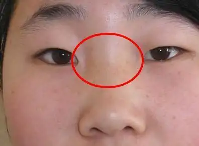 鼻子上有这两条线,福薄命浅苦无边,嫁之前看清