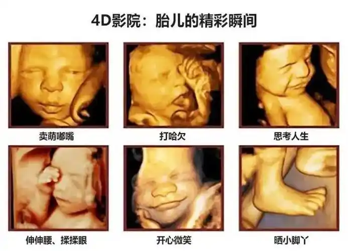 助力健康宝宝幸福千家万户蓝田县人民医院功能科正式开展胎儿四维彩超