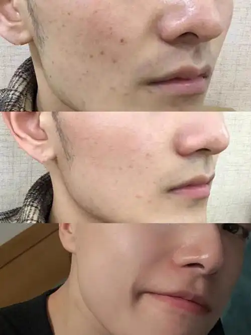 细腻干净的皮肤