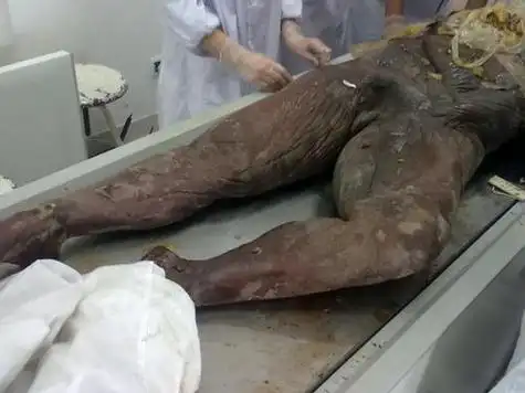 法医 陈燕 解剖活体女尸