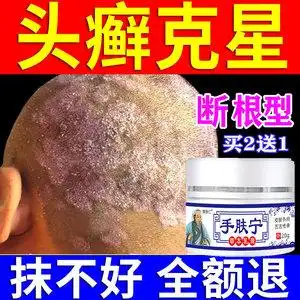 【头藓药膏头癣】头藓药膏头癣品牌,价格 - 阿里巴巴