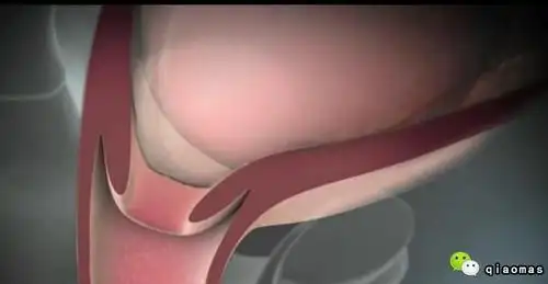 顺产全过程真实现场实拍生孩子就是这么回事