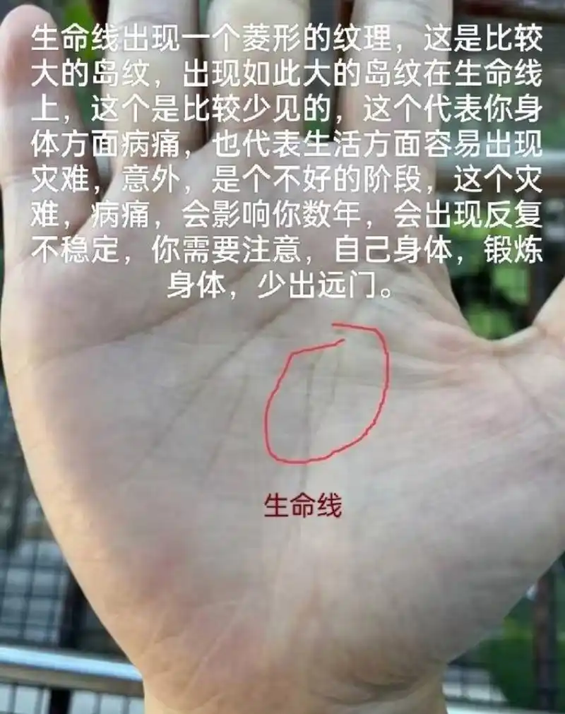 生命线出现一个菱形的纹理,这是比较大岛纹,出现如此大的岛纹在生命线