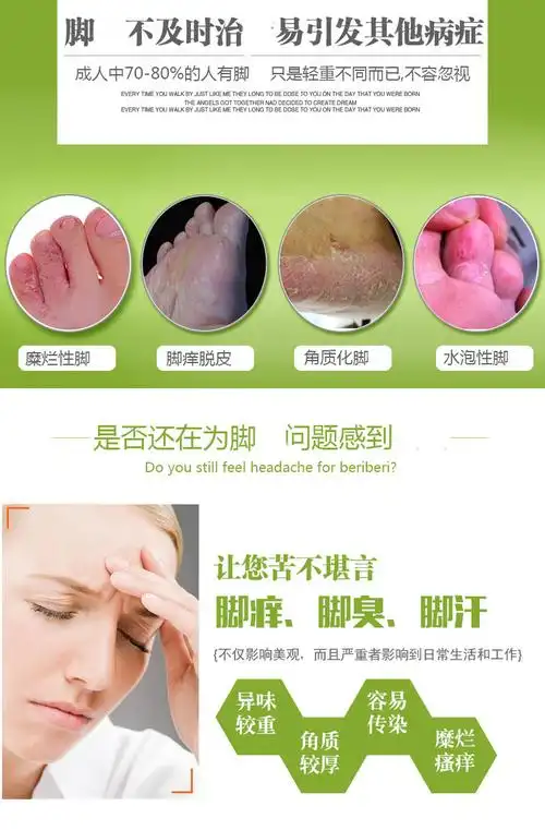 【买2送1】夫洁美宝 烂脚丫脚气软膏止痒脱皮水泡型膏王杀菌泡脚
