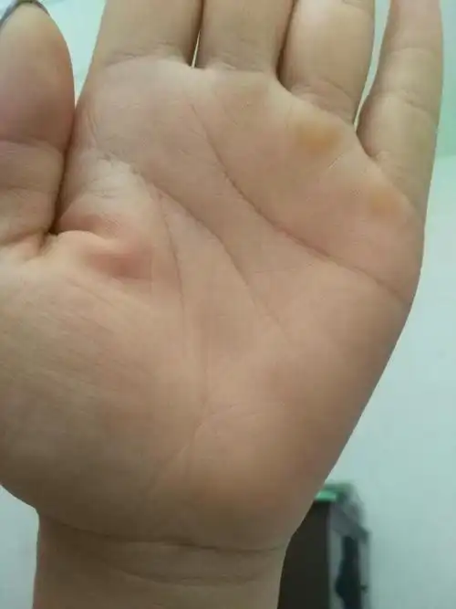 我,女,29,两只手生命线都很短有正常人一半是否生命很短求解?