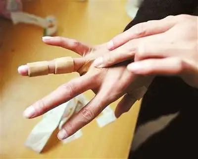 2015年,一名魔术师为抓破的手贴创可贴.新华社发