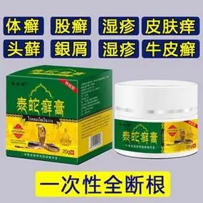 泰国进口治疗顽固牛皮癣藓鲜银屑病湿疹外用皮肤病头专用特效药膏_阿