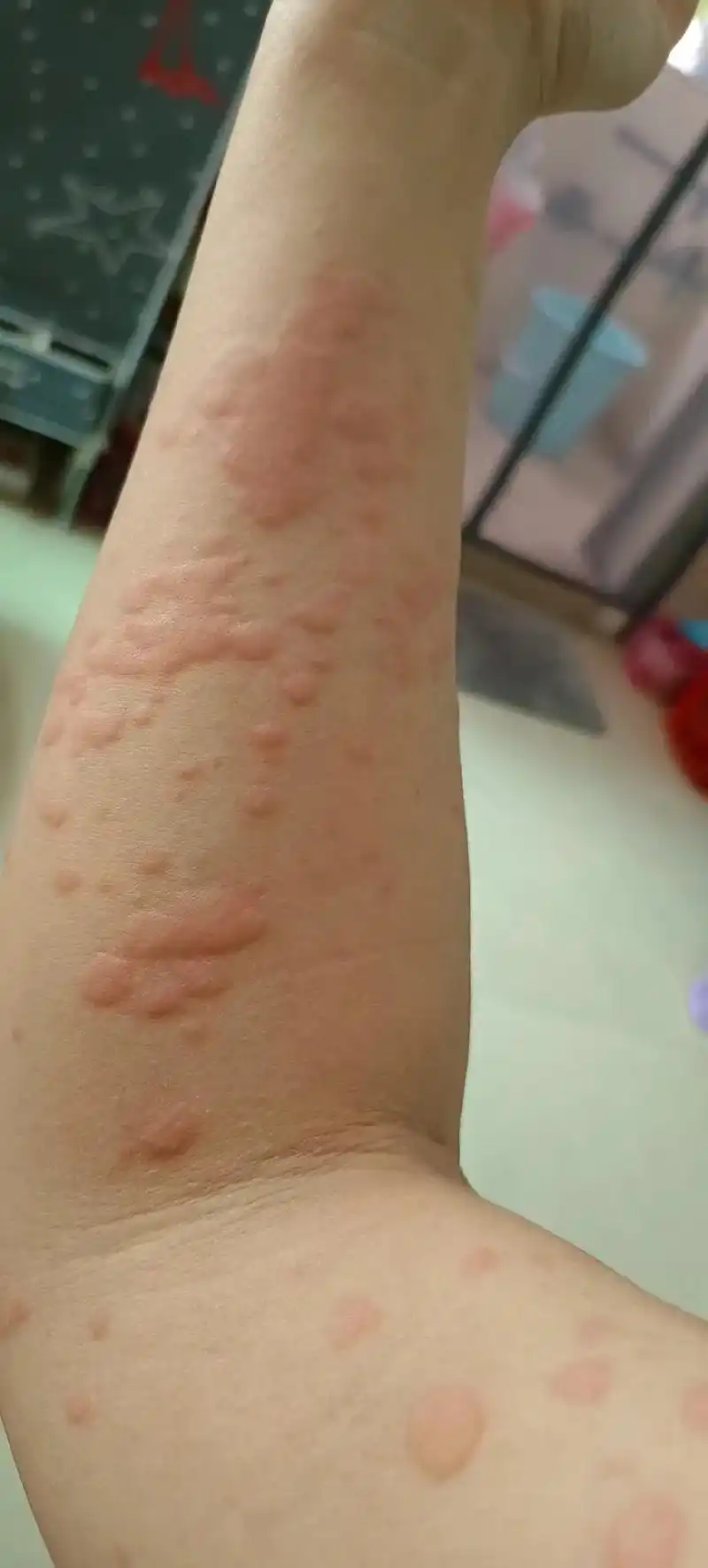 荣华富贵和身体健康,对我来说,身体健康最重要,如果可以选择, - 抖音