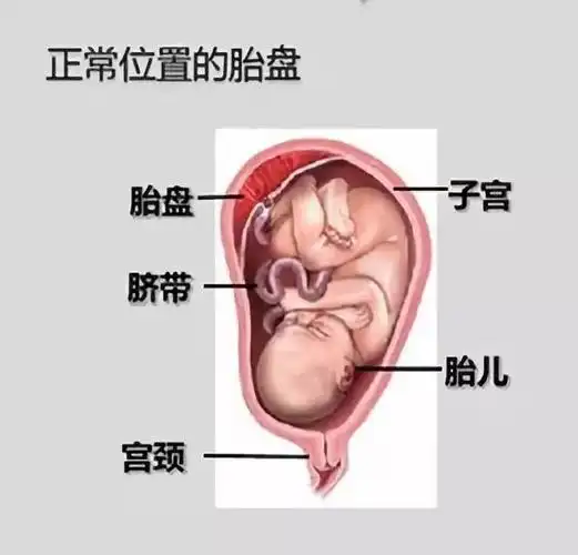 正常的胎盘是附着于"袋子"即子宫体的后壁,前壁,或侧壁,通过脐带给