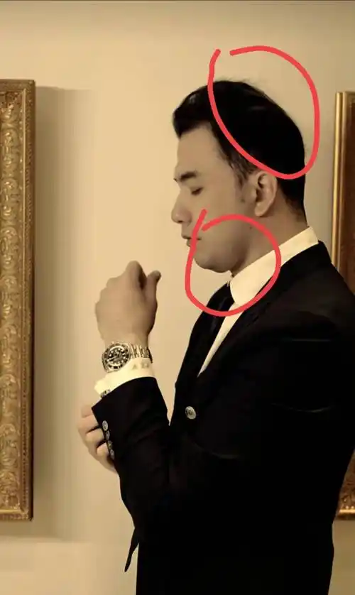 又秃了一个男明星,粉丝还以为他是大扁头_黄志玮_视频_头发