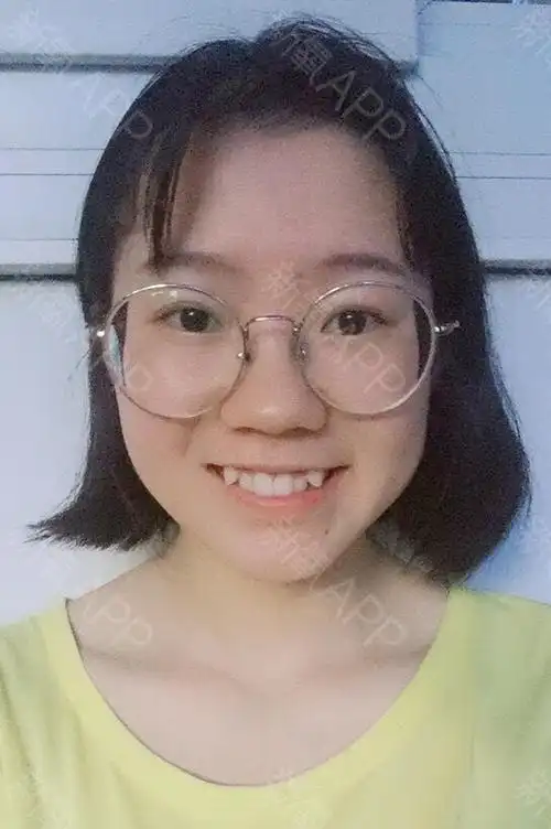 新氧- 杨芯欣向荣 | 牙齿 | 牙齿矫正 | 牙齿美