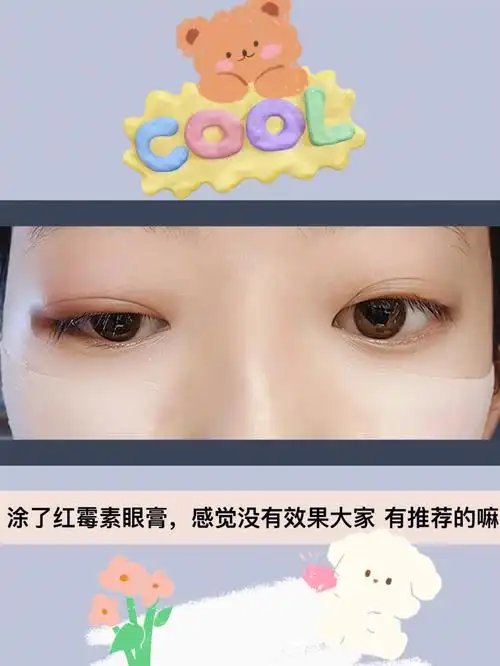 因为封校不能出校门,在校医务室拿了#红霉素眼膏   涂了一次,还有点