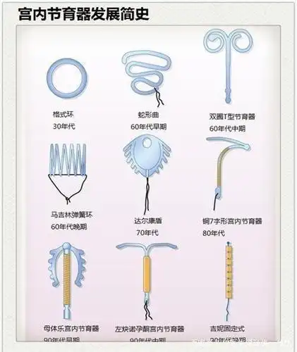 我年纪60岁了,节育环放了30多年,还能取出来吗?