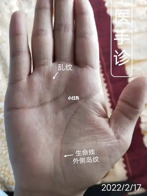 你的手上有岛纹吗