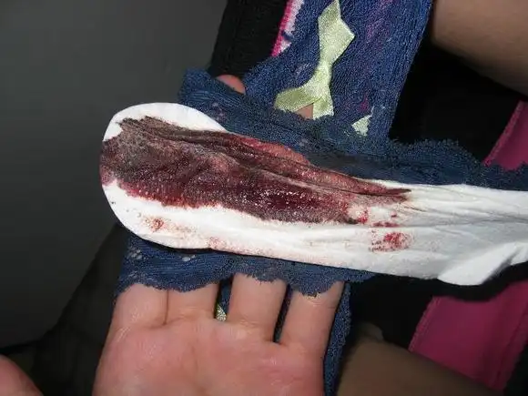 大姨妈血_初中女生大姨妈表情_女生大姨妈流血图片