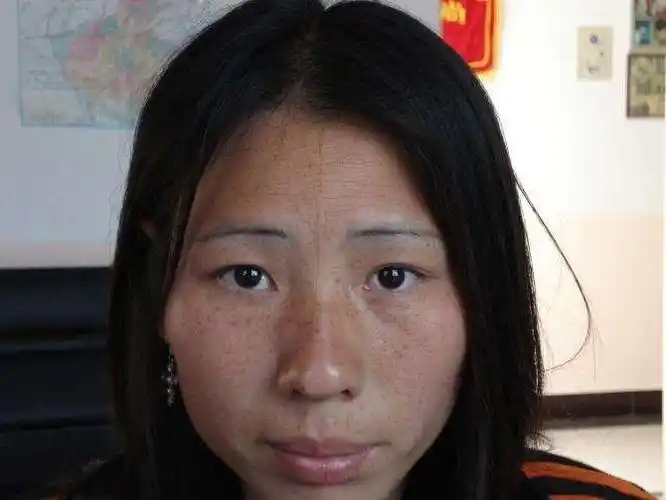 皮肤暗黄是什么原因引起的? 你不懂就只有成黄脸婆了