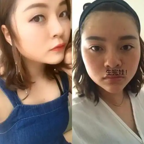 这几组女人生孩子前后对比照,反差太大,连亲妈都不一定认得出