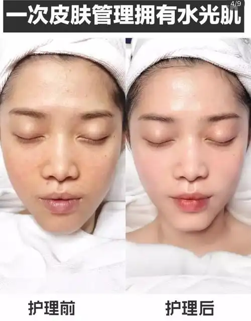 值哭只要399元即可享受695元密集水光皮肤管理12元单色美甲