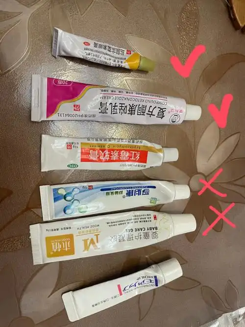 药膏都不怎么起作用 也看了医生给我推荐了两种药(咱就是说一点不好用