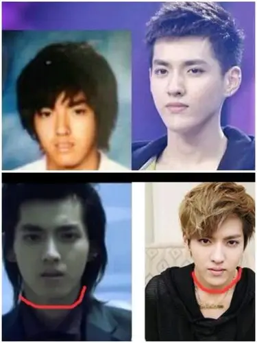 吴亦凡到底整没整,看以前的照片和现在照片很是感觉他_圈子-新氧美容