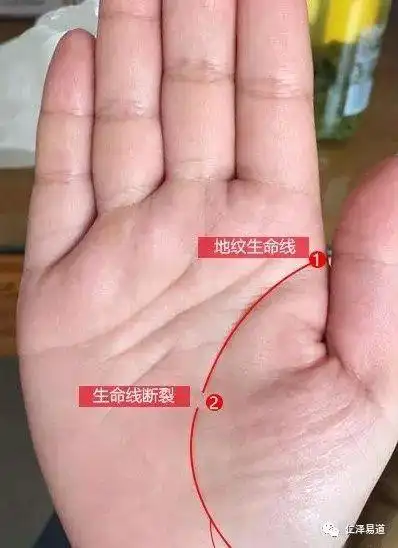手相生命线断裂,竟然是因为减肥过度!