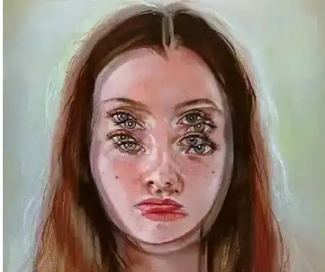 近视眼都有怎样的共鸣?