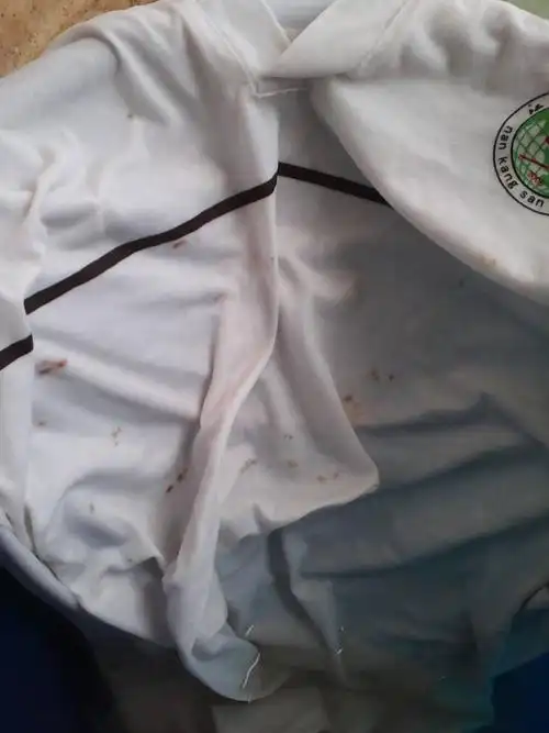 我的一件白色校服有好多污迹,洗了也除不掉,用漂白粉也没用,请问还有