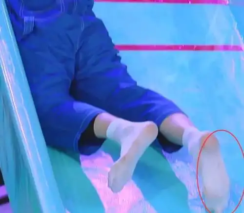 蔡徐坤不小心从滑梯上摔倒看了他的袜子亮了这是有几天没洗了