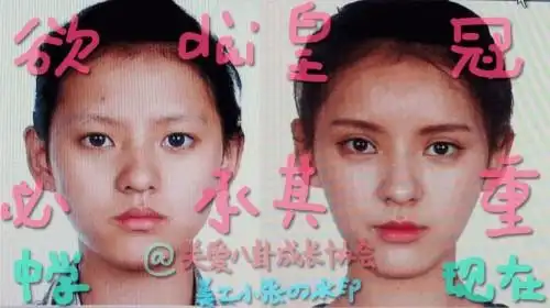 王思聪张予曦整容