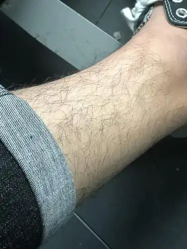 夏天 男生穿短裤 到底该不该刮腿毛呢