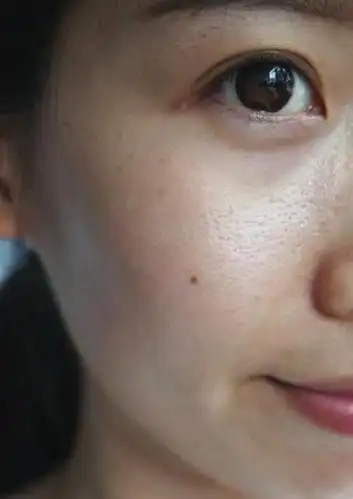 皮肤严重缺水时,脸部肌肤会发出5个"信号",看看你中招了吗?