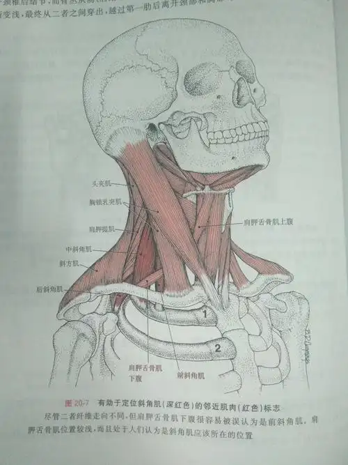 斜角肌―肌筋膜疼痛与功能障碍第一卷