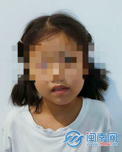 龙海一7岁女童治好感冒 脖子却"歪"了