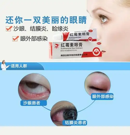 眼睑炎眼睛红血丝眼睛发炎眼药膏可购眼药水滴眼液dt红毒素膏红梅素