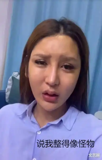 女网红整容失败出现严重后遗症,脸肿成馒头眼睛睁不开,崩溃痛哭称自己