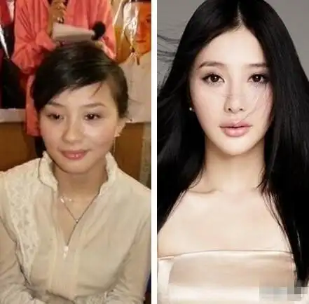 李冰冰整容前后对比照