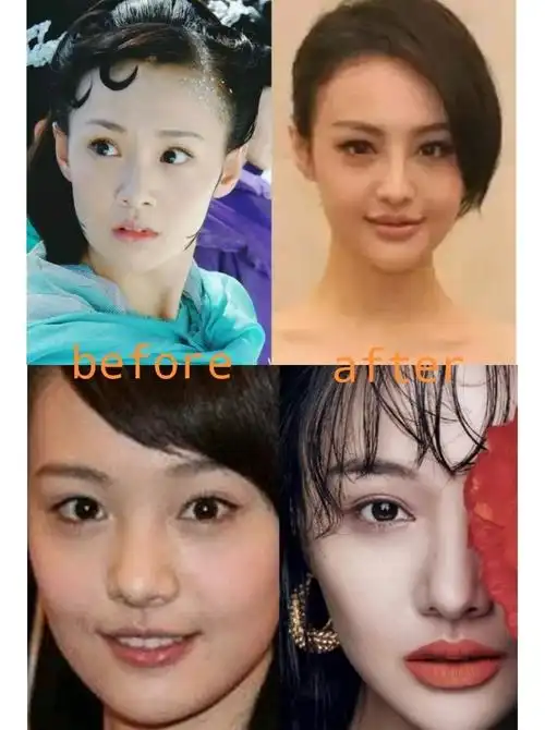 郑爽是在娱乐圈中难得会公开承认自己整容的女星,是新一代耿直少女没