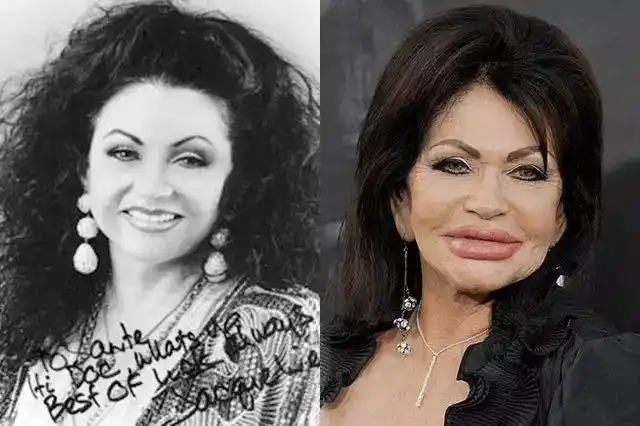 史上整容最失败的20位明星最后一位惨不忍睹