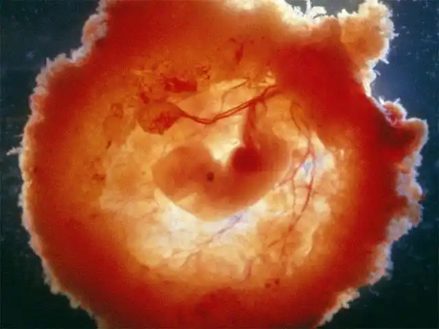 孕妈早知早好|胎儿|怀孕|胎停育|孕酮|胎儿发育_网易订阅