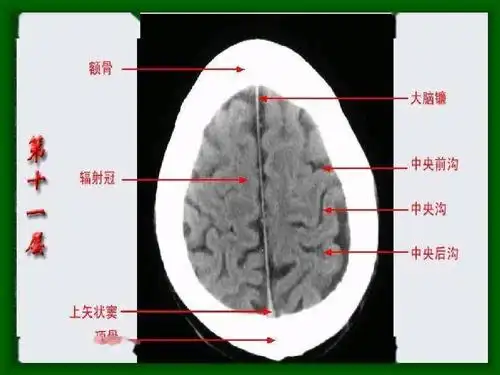 头颅ct 解剖图谱,人手一份