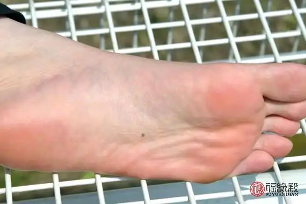 脚底板长痣的痣相图解脚底板痣含义