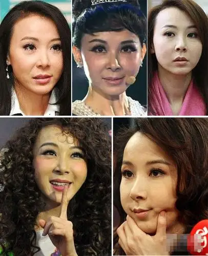 女星到底整没整容? 面部离奇水肿丑哭(组图)