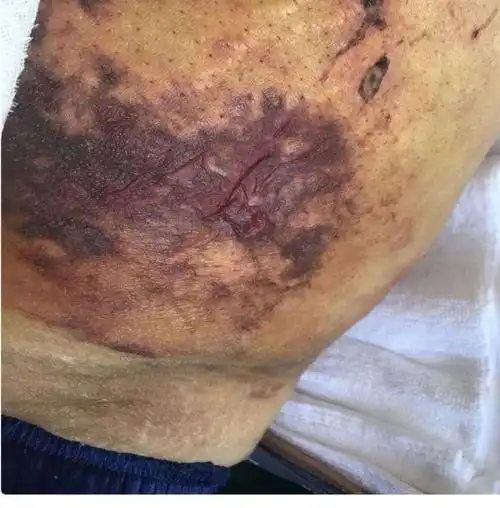 赤峰星傲医疗美容门诊部做抽脂美体变丑体