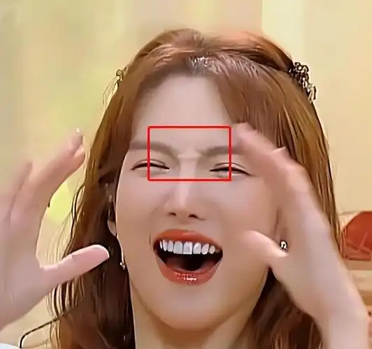 "森白牙,巫婆鼻,刀削脸",演艺圈的明星,果然把脸玩"透"了