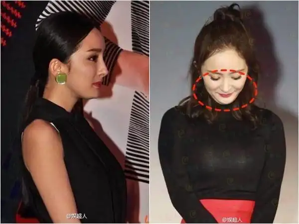 杨幂下巴突出部分被网友质疑是整容的后遗症.(图/翻摄自微博)