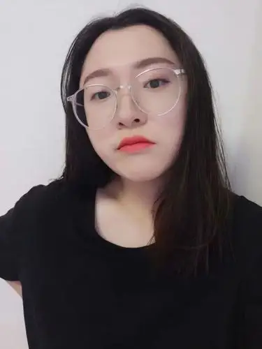 眼科咨询客服小美女告诉您近视手术我做过安全靠谱