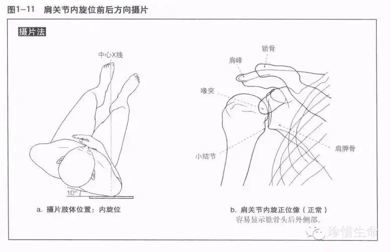 肩关节x线检查体位大全 - 好医术早读文章 - 好医术-赋能医生守护生命