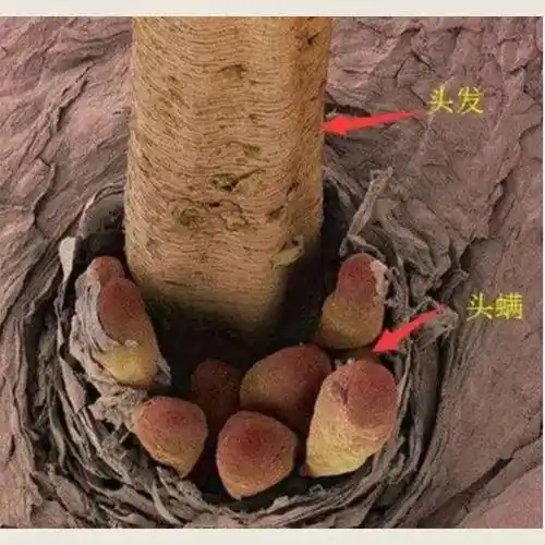 头皮_问题_头发